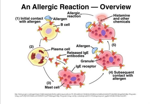 Allergy Management Allergy Management